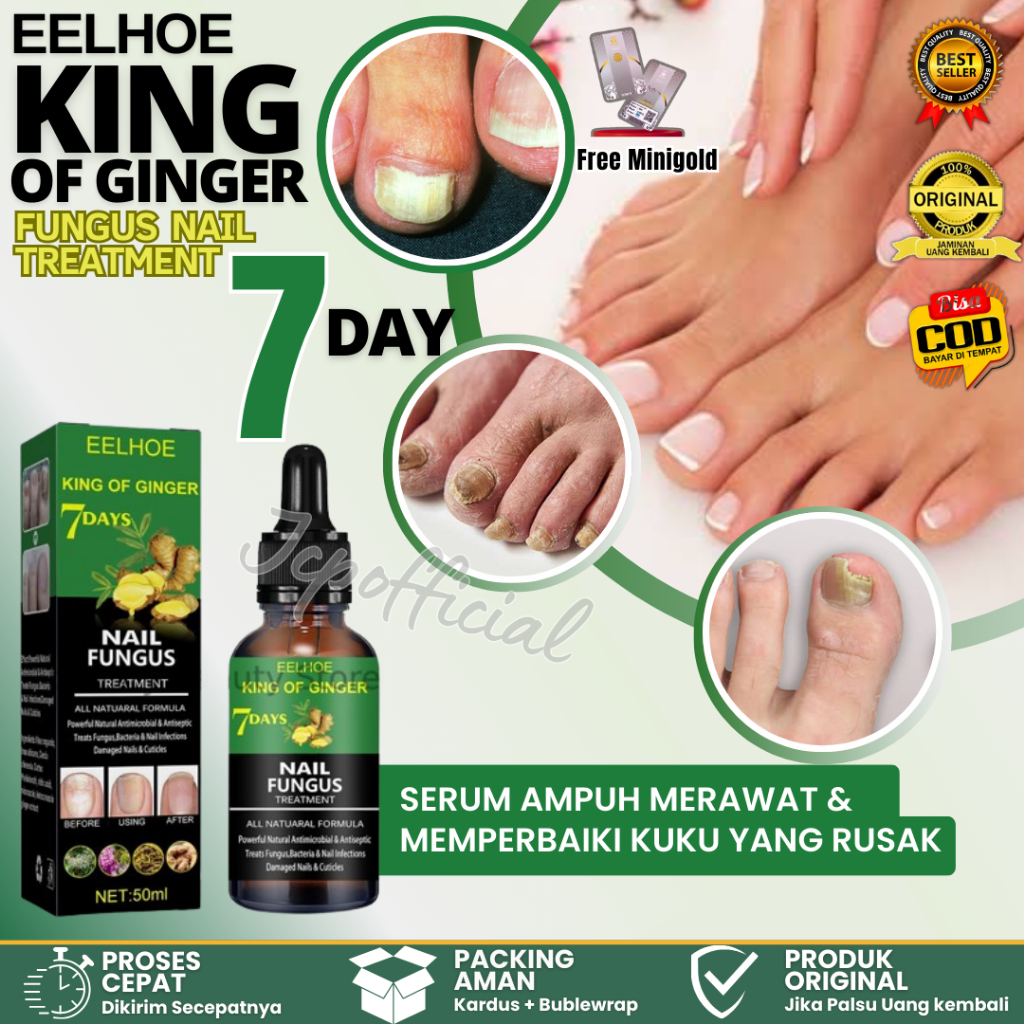 EELHOE King Of Ginger 7 Days Nail Fungus Treatment 50ml Nail Repair Lotion Repair Gray Nails Bright 