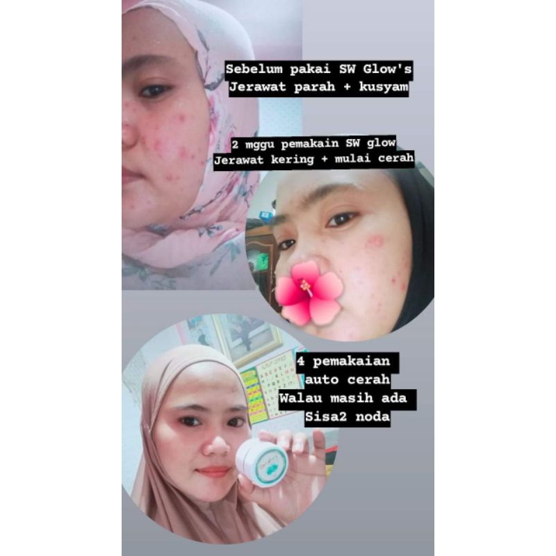 SW GLOW'S SKINCARE BPOM