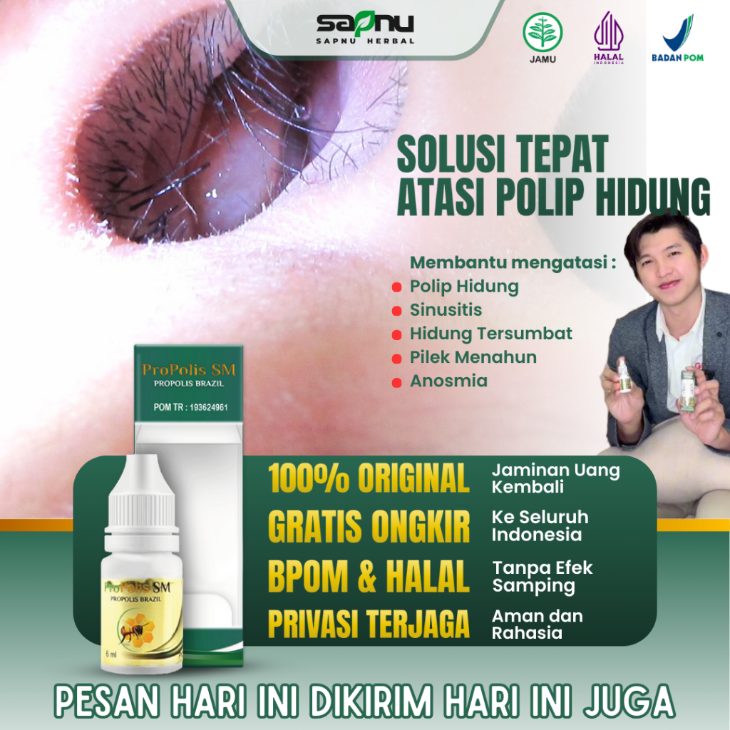 Obat Polip Hidung, Obat Polip Hidung Semprot, Polip Hidung Untuk Dewasa & Anak Anak, Obat Sinusitis 