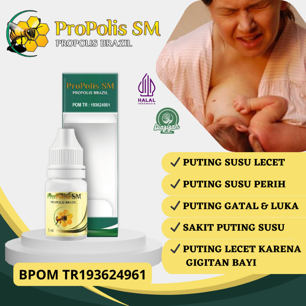 Obat Puting Susu Lecet, Obat Puting Susu Perih, Obat Puting Susu Nyeri dan Bengkak, Obat Puting Susu