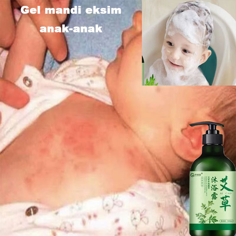 Sabun Mandi Anak Sabun Acnes Shower Mandi Penghilang Tungau Bayi Sabun Mandi Bayi Memutihkan Dan Ant