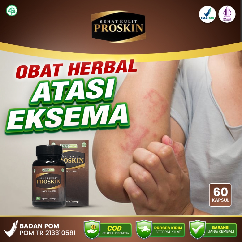 Proskin Obat Herbal 100% Original BPOM Halal MUI - Obat Ekzema Kurap Kudis Herpes Psoriasis