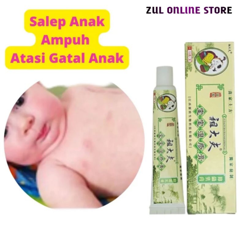 salep zudaifu kulit gatal pada anak balita gatal selangkangan/alergi/bintik merah pada anak