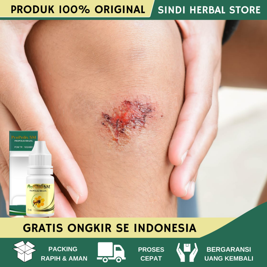 Obat Luka Diabetes Basah Bernanah, Obat Pengering Luka Diabetes Bernanah, Obat Luka Diabetes Agar Ce