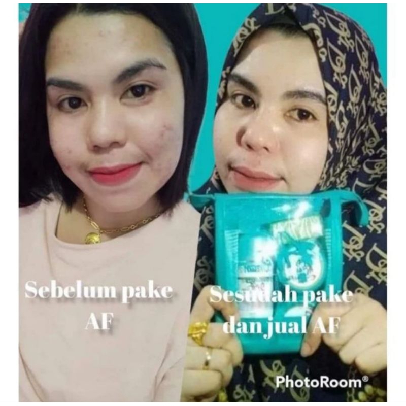 CREAM AF PAKET DOBLE GLOW "MAKASSAR"