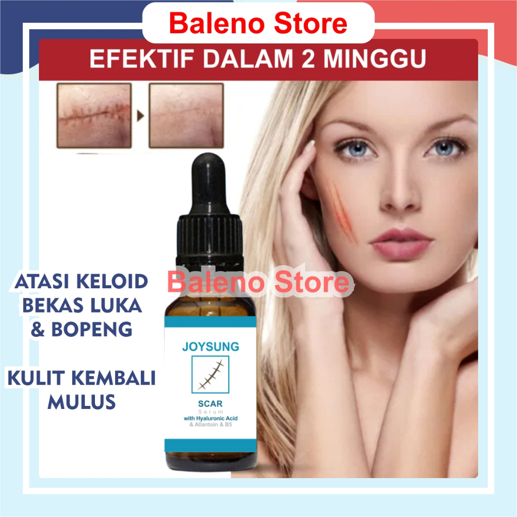 Scar Repair Serum Penghilang Bekas Luka Keloid Bopeng Jerawat Hitam di Wajah Scar Keloid