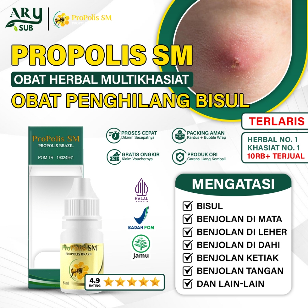 Obat Penghilang Bisul, Cenang, Bisul Menahun Di Ketiak, Kepala Paling Laris Propolis SM Brazil Asli