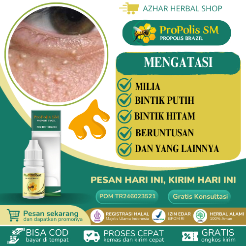 Propolis SM Obat Milia Di Bawah Kelopak Mata Bintik Putih Bruntusan Flek Hitam Bintik Hitam