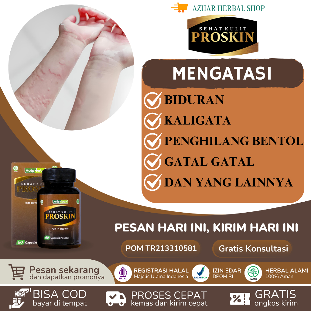 Proskin - Obat Biduran Gatal Kulit Alergi Dingin Penghilang Bentol Gatel Alergi Kaligata