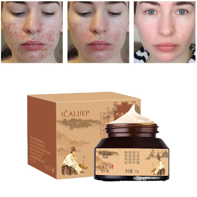 acnes creamy wash krim jerawat salep jerawat dan bekas jerawat Krim Penghilang Bekas Jerawat salep j