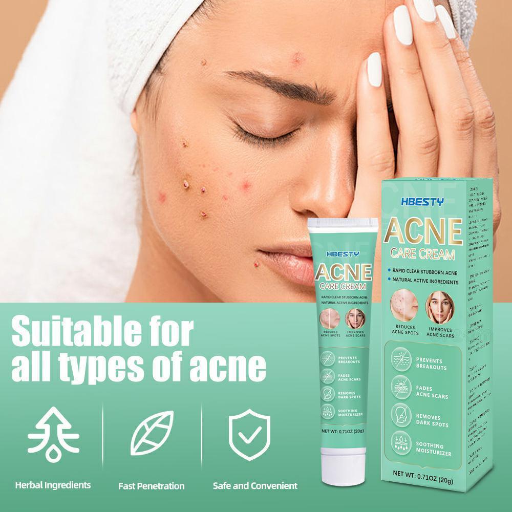 Salep Jerawat Penghilang Jerawat Dan Bekas Cream Pemutih Waj Glowing Acnes Penghilang Jerawat Moistu