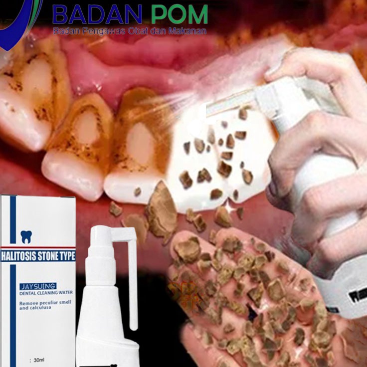 Pembersih karang gigi Alat pembersih karang gigi Perontok karang gigi paling ampuh Karang gigi 3ml p