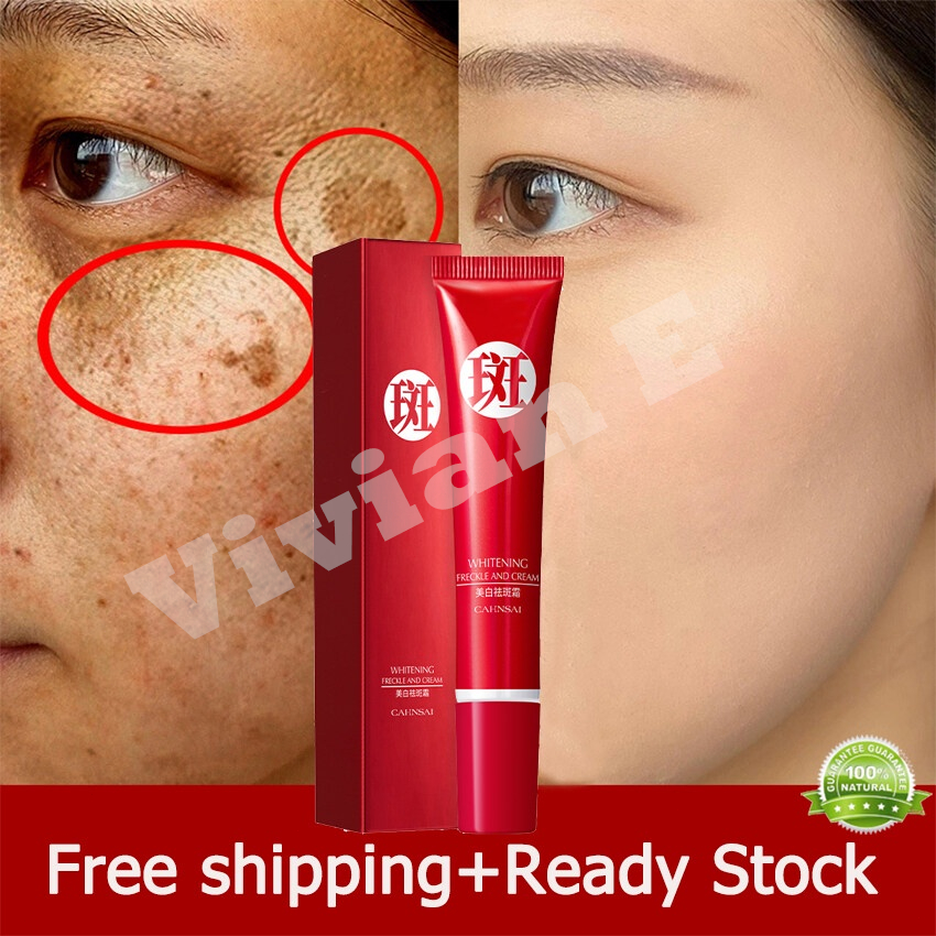 【Ori】Penghilang flek hitam Cream penghilang flek hitam di wajah Salep flek hitam Melasma Cara ampuh 
