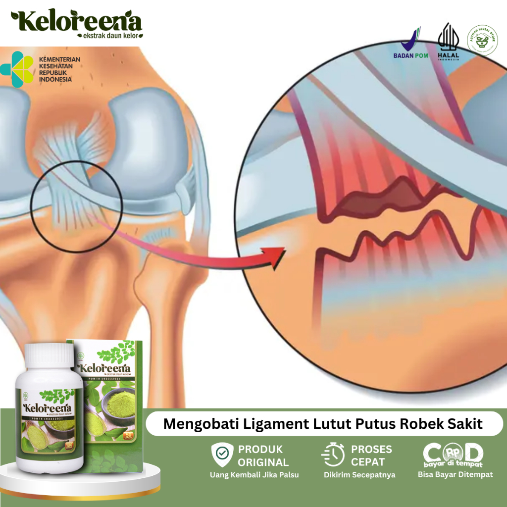 Obat Ligamen Putus, Obat Ligamen Lutut Robek, Obat Lutut Bengkak, Obat Cedera Otot Lutut, Obat Lutut