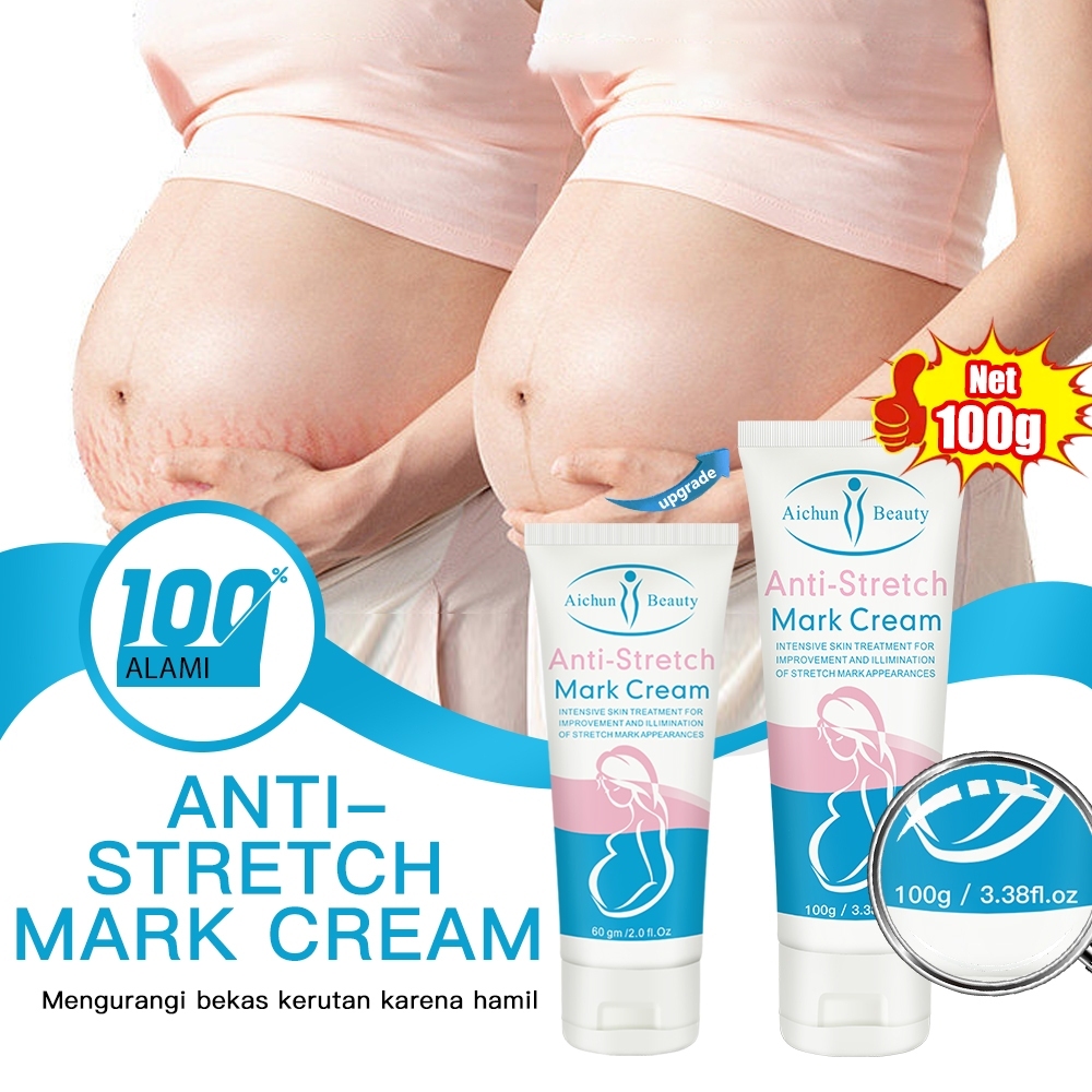 AICHUN BEAUTY Stretch Mark Cream Krim Stretch Mark Pasca Melahirkan Krim Penghilang Stretch Mark Str
