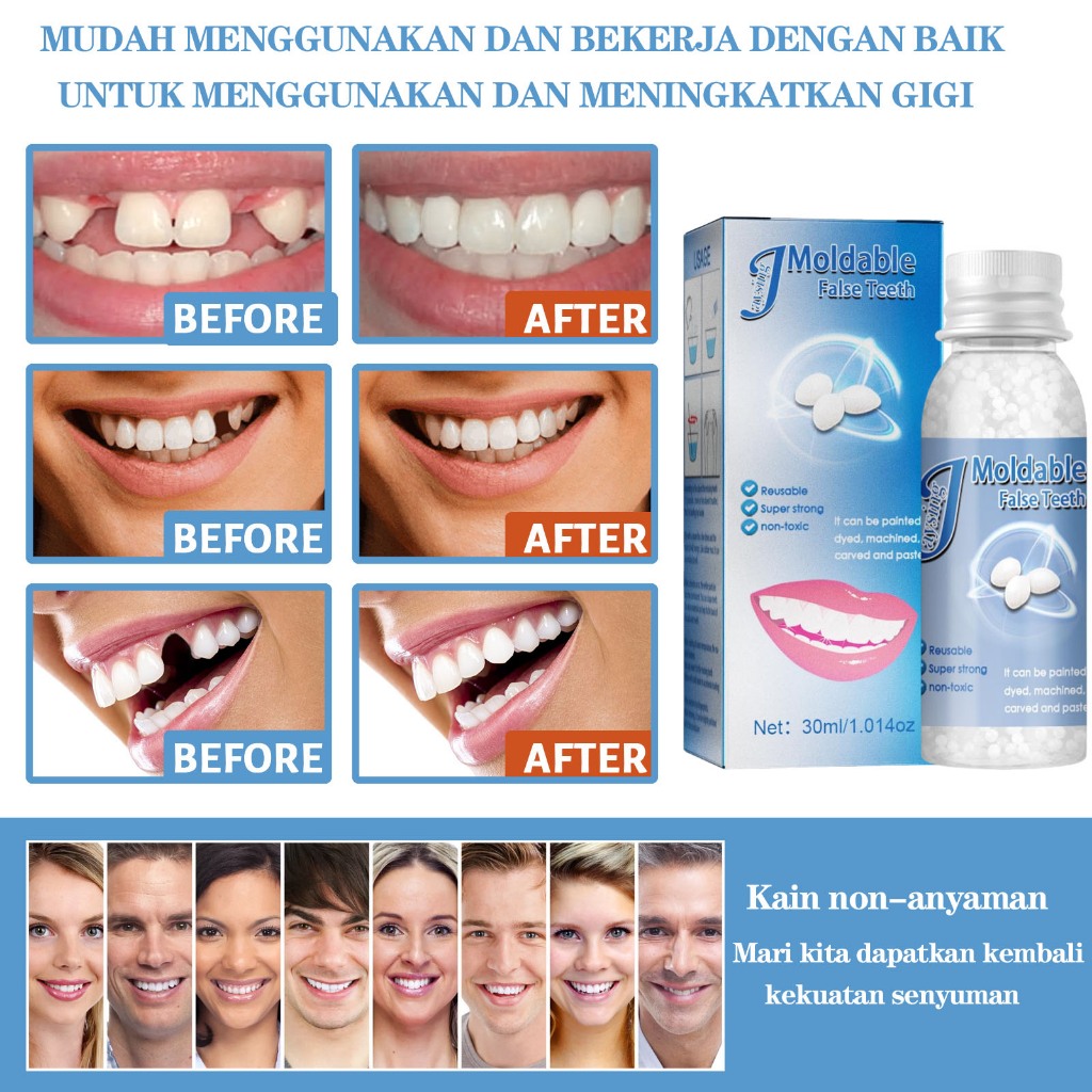 Penambal gigi berlubang tambal gigi permanen penambal gigi permanen 30g gigi palsu gigi palsu asli