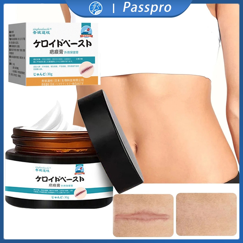 Penghilang Bekas Luka Hitam Koreng Menghilangkan Bekas Luka Dan Koreng Salep Penghilang Bekas Luka H