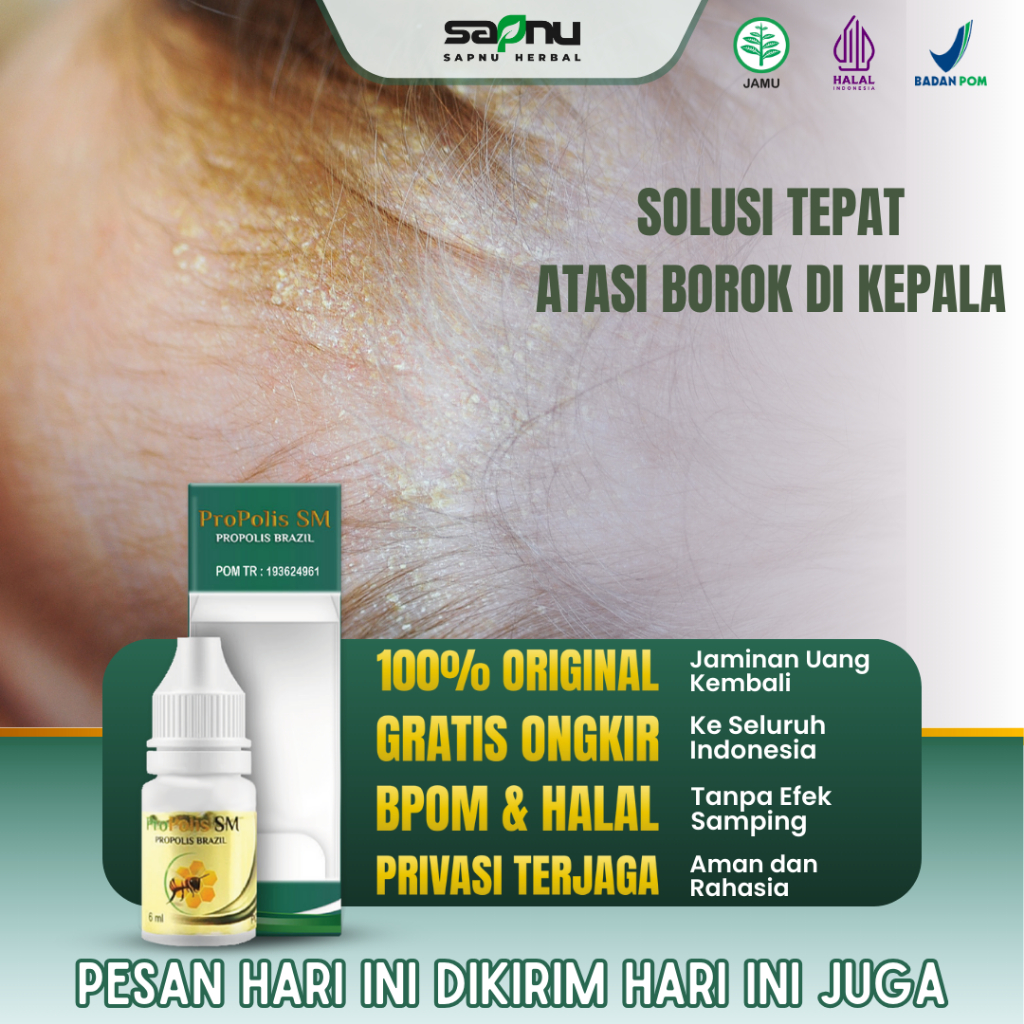 Propolis SM - Obat Borok Kepala, Borok Kepala Anak, Borok Kepala Bayi, Borok Pada Kepala, Borok Kuli
