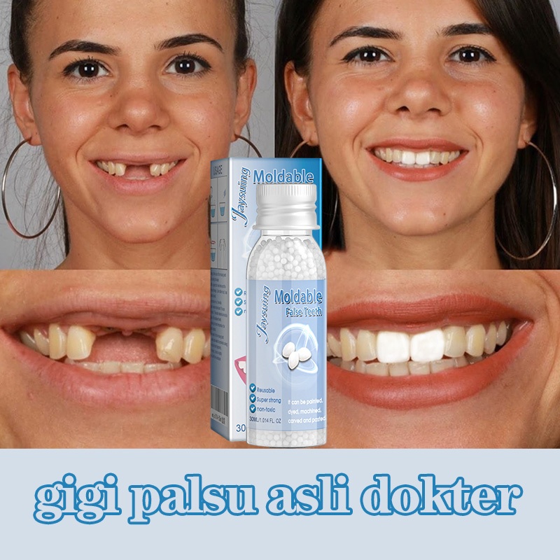 Tambal gigi Gigi palsu Penambal gigi Tambal gigi permanen Penambal gigi berlubang 30ml Penambal gigi