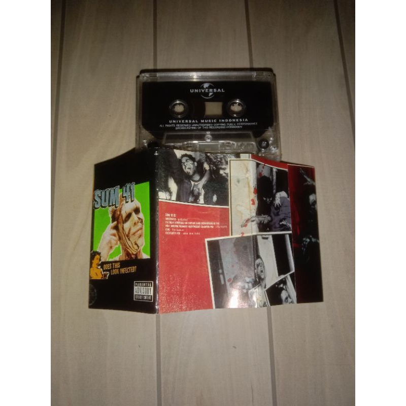 kaset pita sum 41 look does infected