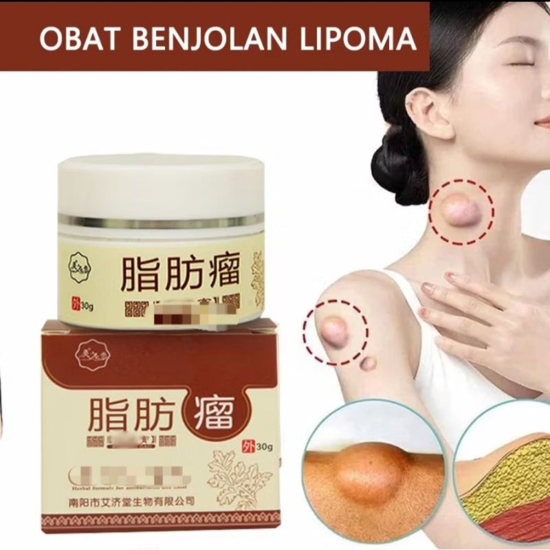 BAO JIAN GAO | SALEP Untuk BENJOLAN/LIMFOMA