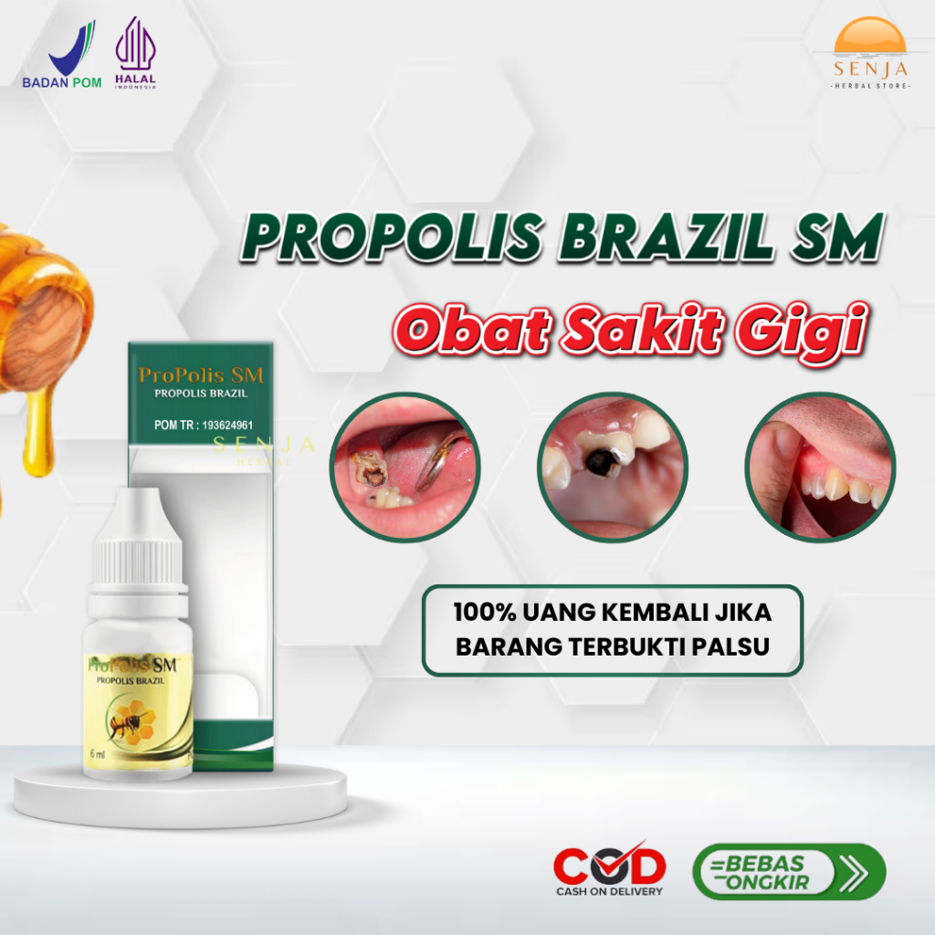 Obat Sakit Gigi Berlubang, Obat Sakit Gigi Anak dan Dewasa, Obat Kumur Sakit Gigi - Propolis SM