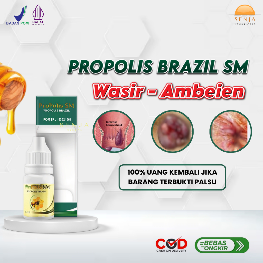 Pengobatan Alami Ambeien dan Wasir, Obat Ambeien Stadium 4, Obat Wasir Berdarah - PROPOLIS SM