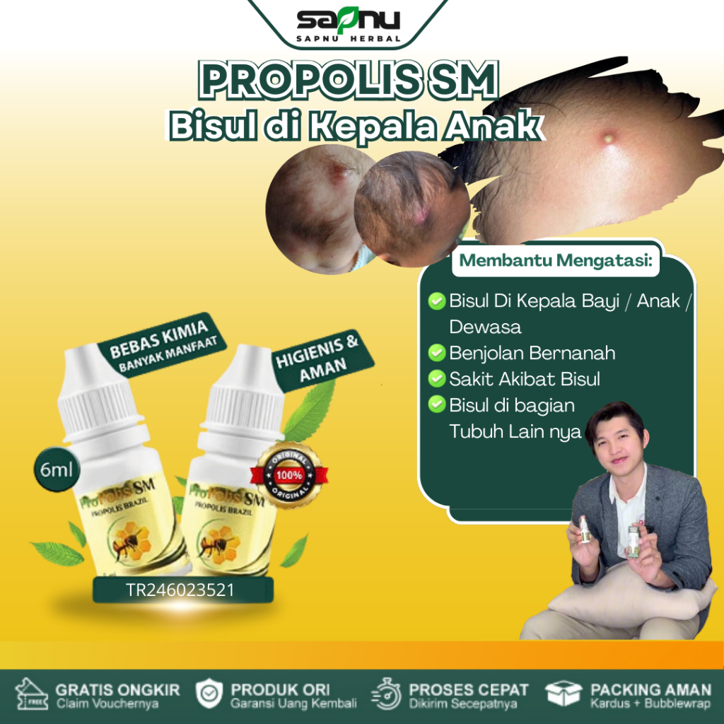 Obat Bisul, Bisul Bernanah, Bisul Di Kepala Bayi / Anak / Dewasa, Bisul di Pantat, Bisul di Tangan, 