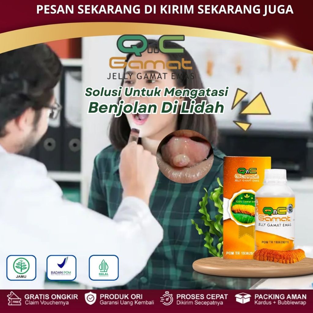 Obat Benjolan Di Lidah, Pengempis Benjolan di Lidah, Sialolitiasis, Lidah Luka-Luka, Kanker Lidah, K
