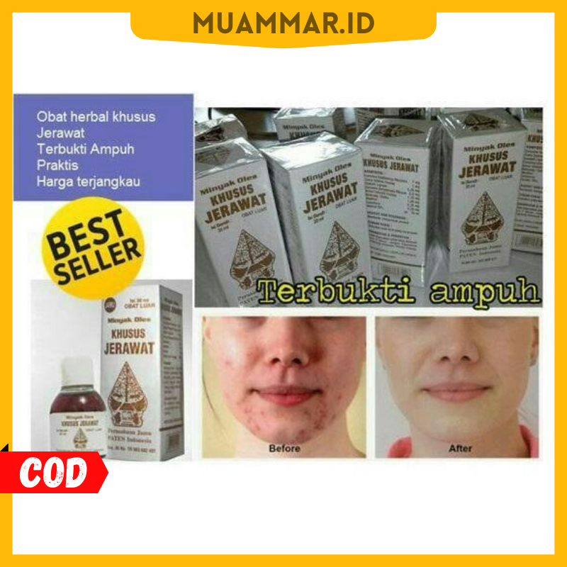Muammar.Id ORIGINAL! Minyak Oles Khusus Jerawat Cap Wayang terbaik / Obat Jerawat Ampuh / Penghilang