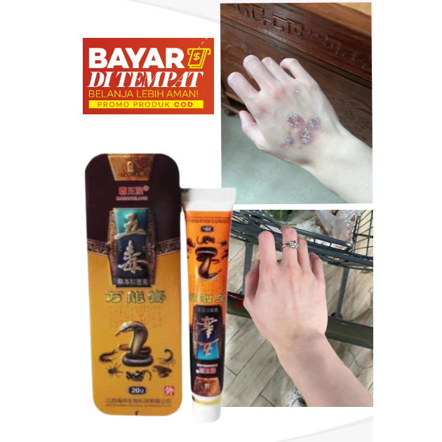 Salep Obat Gatal Eksim Kering Menahun Paling Ampuh Kulit Gatel Exim Basah Saleb Selangkangan Kurap K