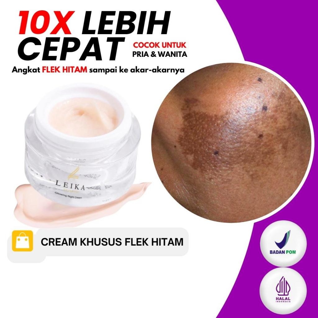 [ BISA COD ] Cream penghilang flek hitam melasma bpom Flek Hitam Membandel Melasma Ampuh Salep Cina 