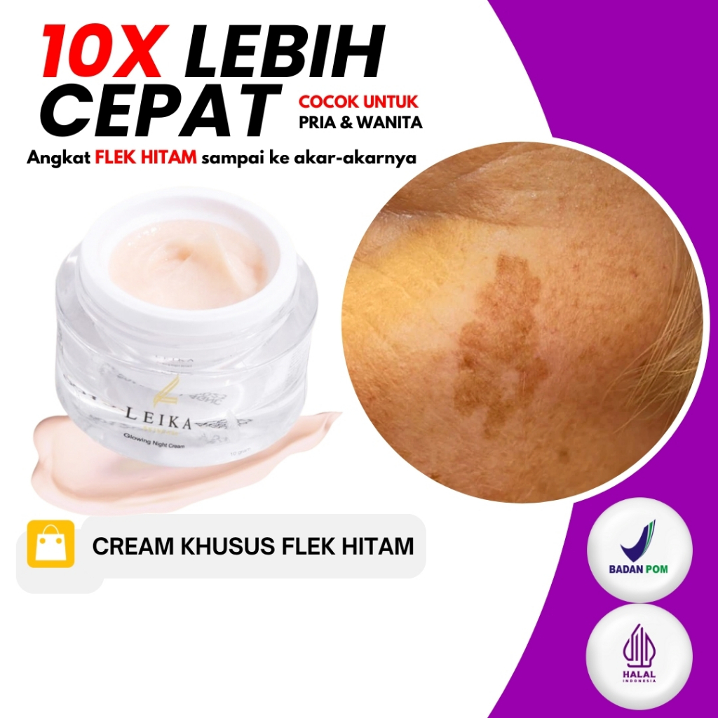 [ PALING AMPUH ] Cream flek melasma ampuh aman Krim kelupas flek hitam membandel flek hitam bopeng b