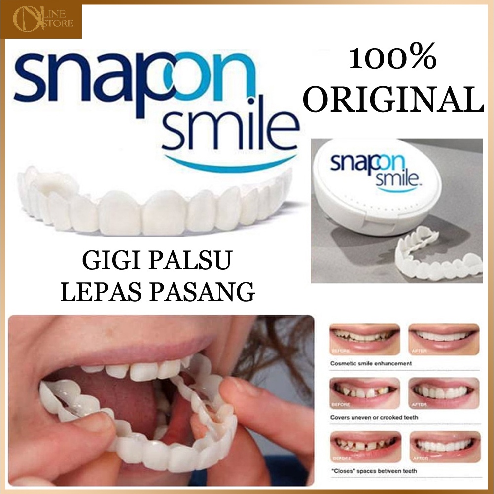 Gigi Palsu Lepas Pasang Veener Pelapis Gigi Atas Bawah Permanen Snap On Smile Original