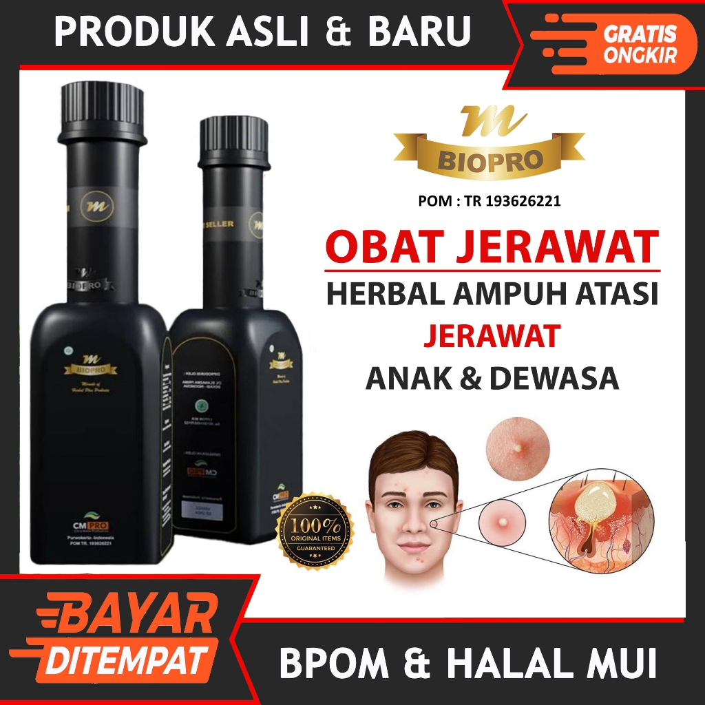 Obat Penghilang Jerawat Wajah Untuk Anak & Dewasa, Bekas Jerawat Punggung, Jerawat Batu Paling Ampuh