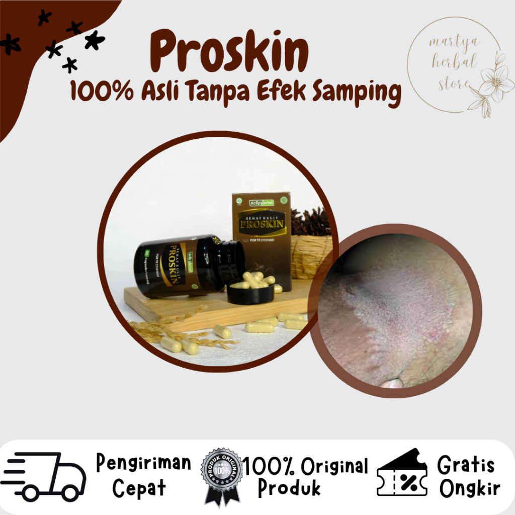 Obat Herbal Gatal Selangkangan Obat Gatal Kulit Jamur Buah Zakar Obat Gatal Selangkangan Pria Dan Wa