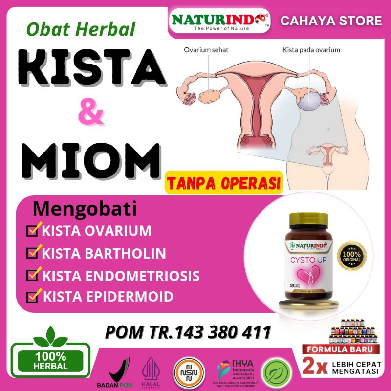 Obat Kista Miom Kista Ovarium Endometriosis Kista Coklat Herbal Ampuh Naturindo