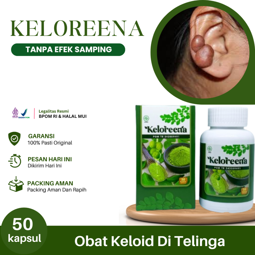 Obat Keloid Di Telinga, Keloid Bekas Tindik, Daging Tumbuh, Keloid Menonjol, Benjolan Di Bawah Telin