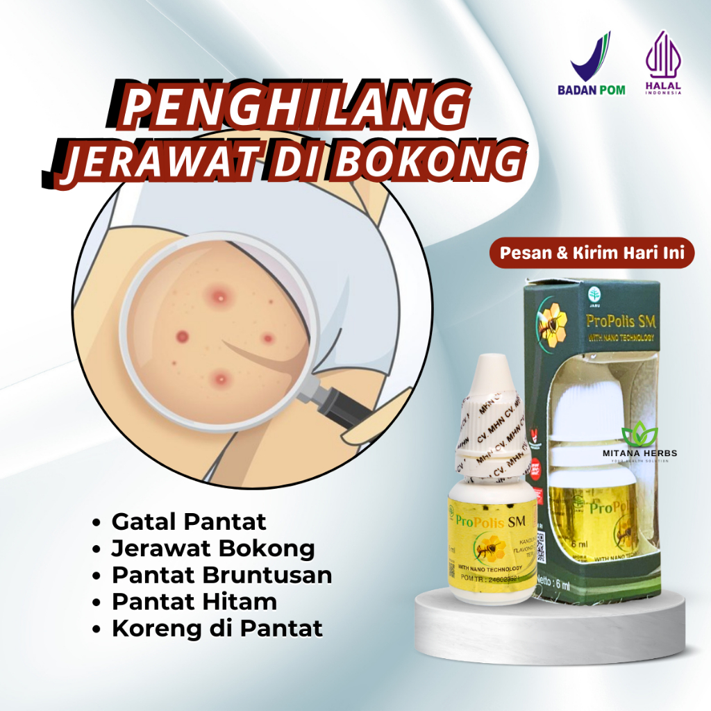 Obat Jerawat Bokong, Jerawat Pantat, Gatal Pantat dan Selangkanga, Pantat Burik Bruntusan Hitam