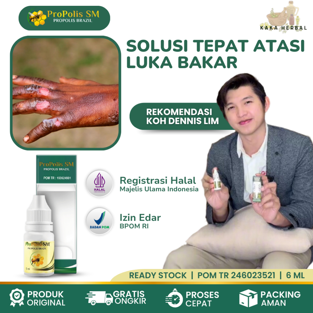 Kaka Herbal - Obat Pengering Luka Bakar, Obat Oles Luka Bakar Cepat Kering, Obat Oles Penyembuh Luka