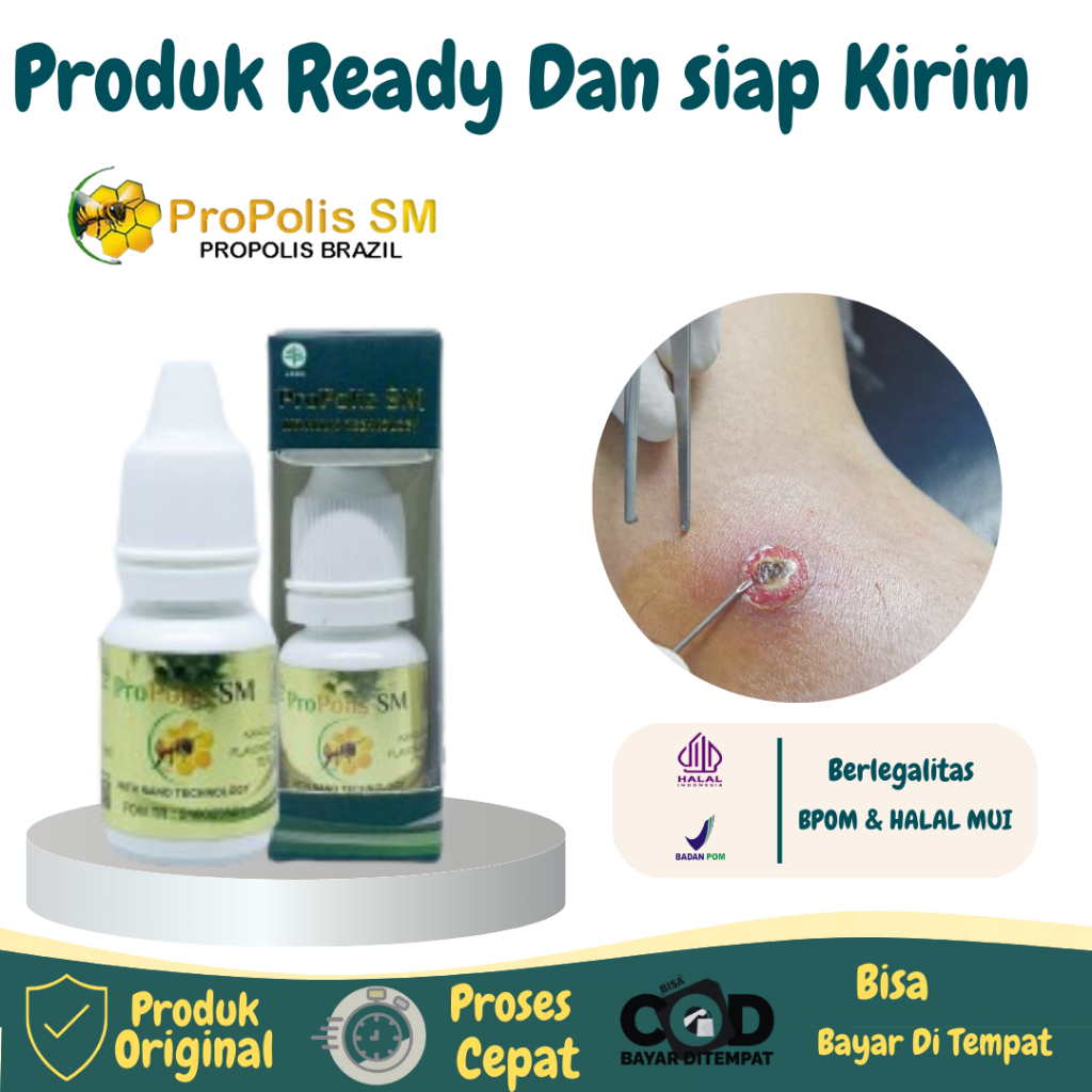 Salep Bisul Merah Bernanah Obat Herbal Bisulan Di Ketiak Obat Pembersih Bisul Obat Tetes Bisul di Pa