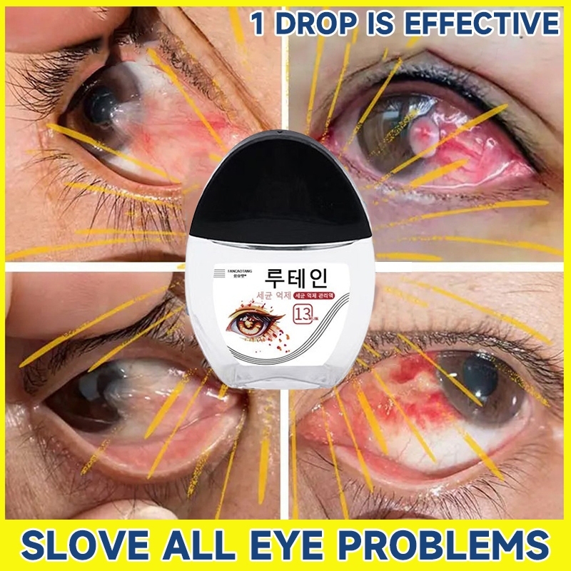 termurah asli Obat Tetes Mata Obat Mata Katarak 13ml Mata Kering Sakit Darah Merah Mata Eye Care Eye