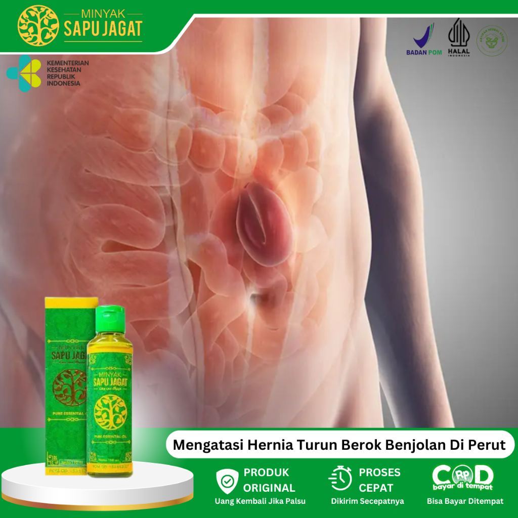 Obat Hernia Turun Berok, Obat Oles Hernia Untuk, Benjolan Di Perut, Benjolan Di Selangkangan, Testis