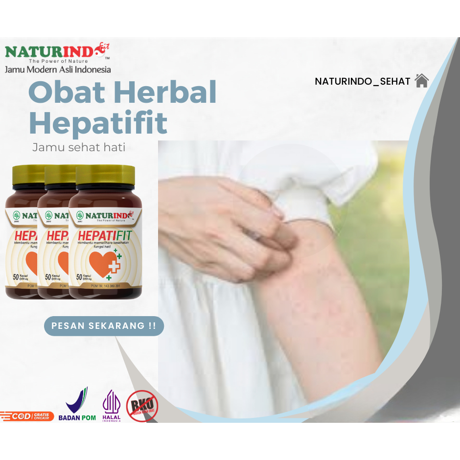 Obat Biduran HEPATIFIT Naturindo