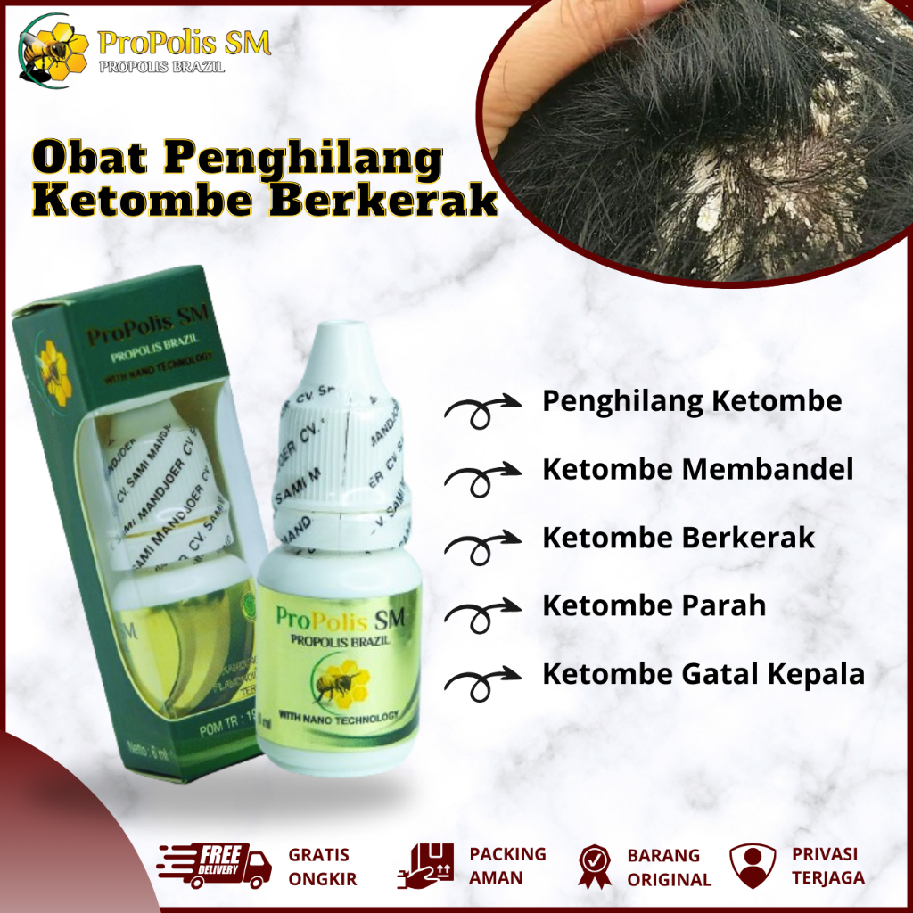 Obat Penghilang Ketombe, Obat Ketombe Parah, Obat Ketombe Bersisik, Obat Ketombe dan Gatal Kulit Kep