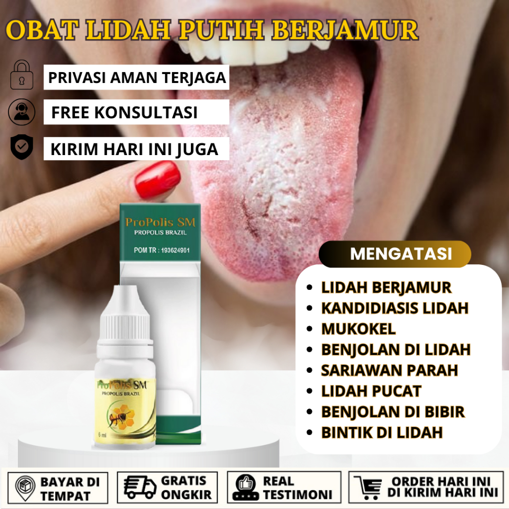 Obat Lidah Putih Berjamur Pembersih Lidah Penghilang Bintik Putih Lidah Candidiasis Lidah Mati Rasa 