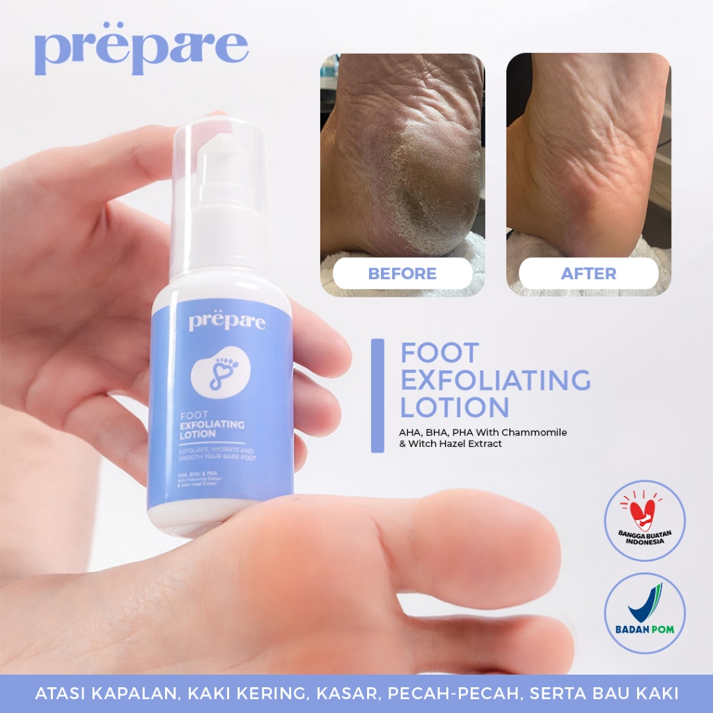 PREPARE Krim Kaki Pecah dan Kering Penghalus Tumit Kaki Obat Kaki Pecah dan Kering Obat Kapalan Kaki