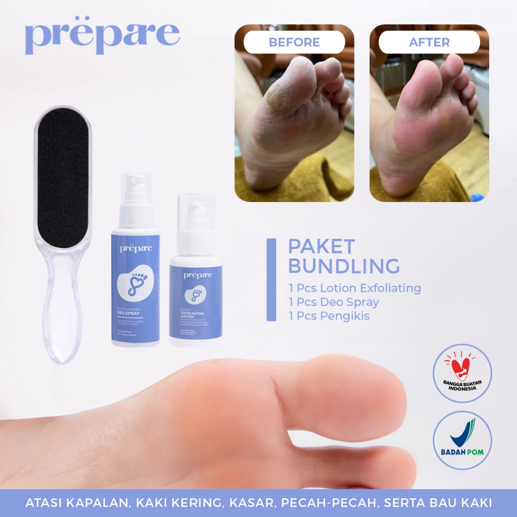 PREPARE - Penghalus Tumit Kaki Kasar Penghilang Kapalan Obat Kaki Pecah dan Kering Obat Bau Kaki