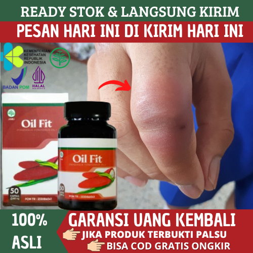 Obat Jari Tangan Bengkak, Obat Jari Tangan Bengkak Karena Asam Urat, Obat Jari Tangan Sakit Dan Kaku