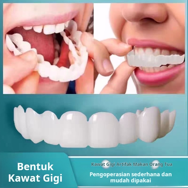 Kawat gigi simulasi – Kawat gigi yang memberikan tampilan gigi hilang